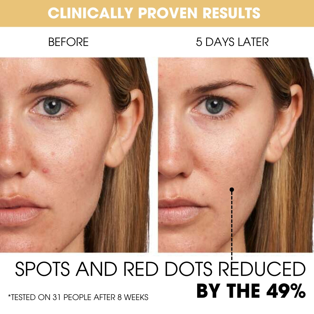 Advanced Korean Encapsulated Vitamin C Technology for Brighter, More Even-Toned Skin