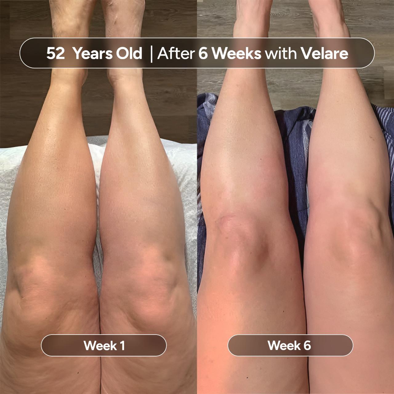 Anti-Cellulite Massage Oil