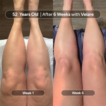 Anti-Cellulite Massage Oil