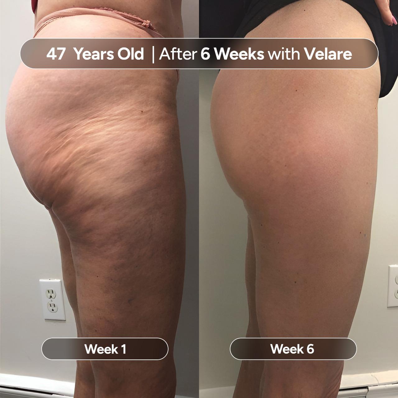 Anti-Cellulite Massage Oil