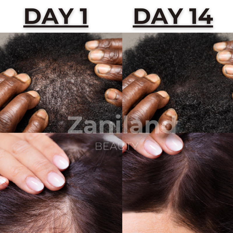 Hair Growth Scalp Ampoule