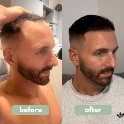 Zaniland - Hair Growth Serum